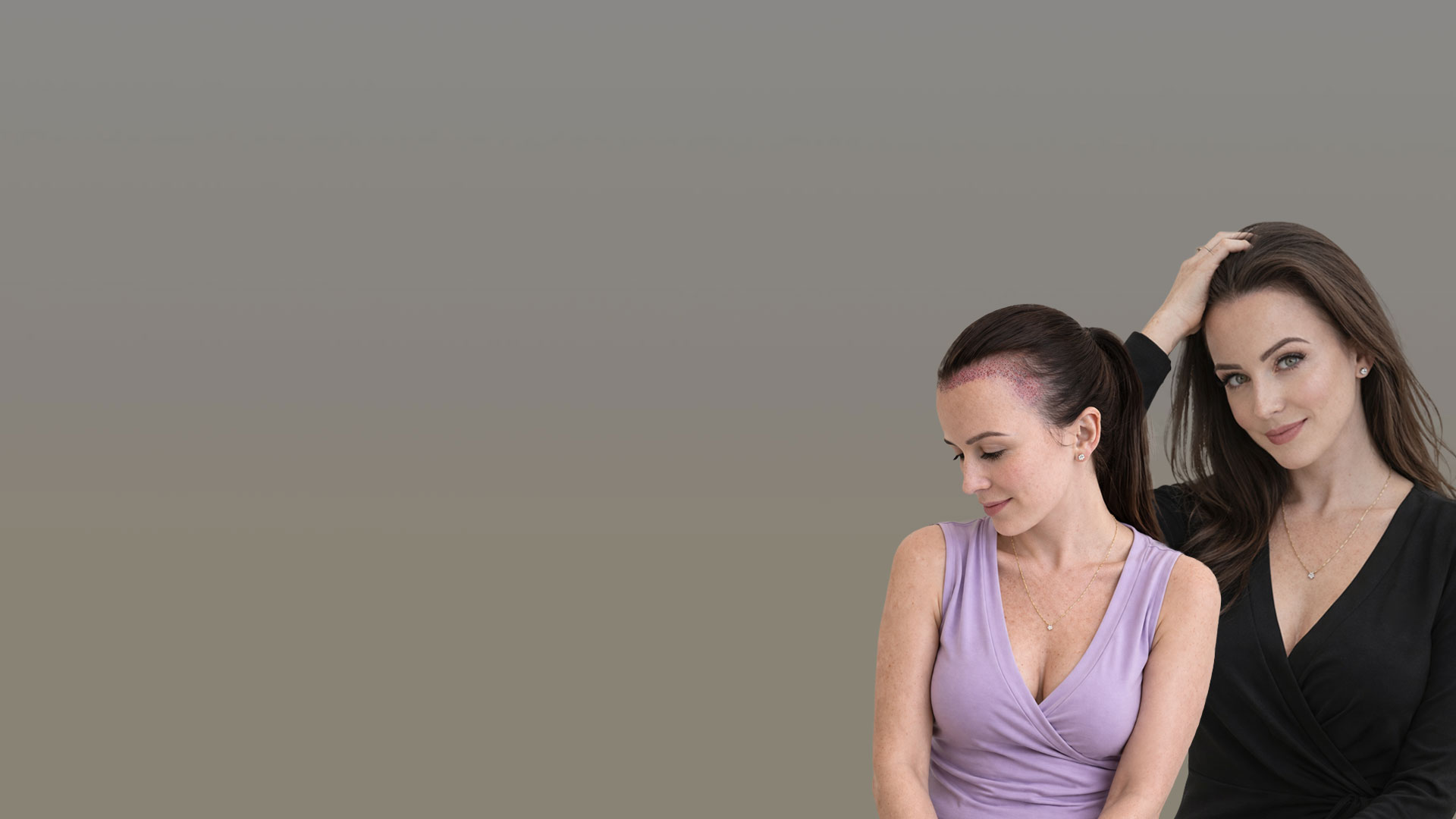 Пересадка волос у женщин