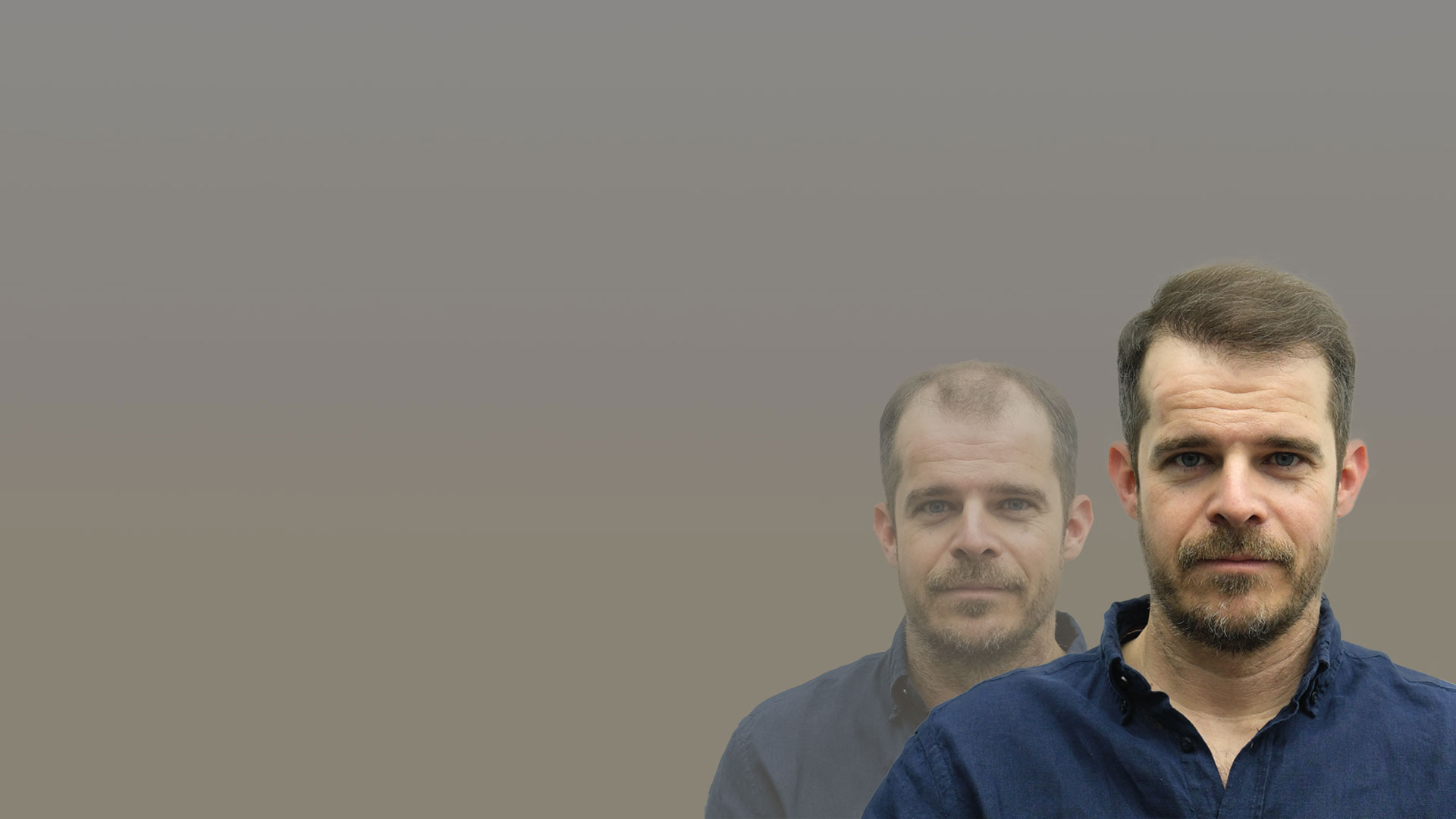 Пересадка волос в Москве