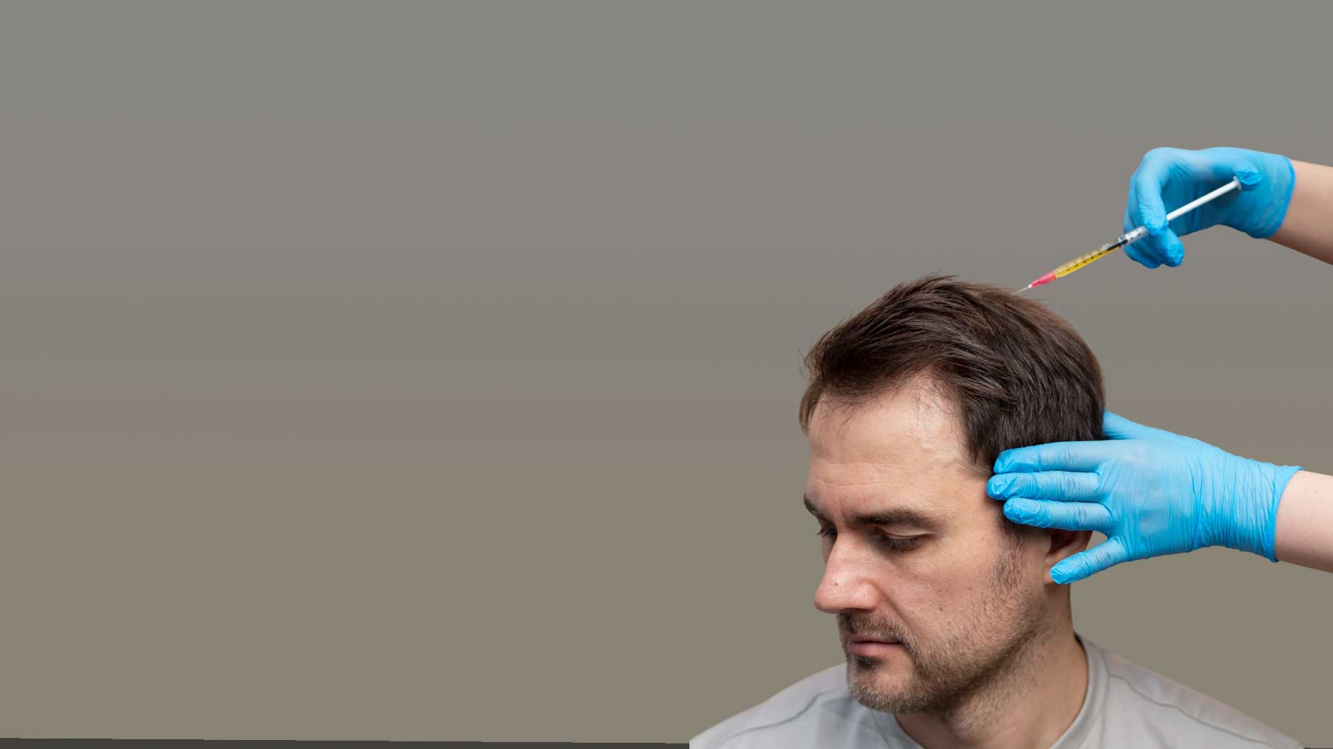 PRP-терапия волос